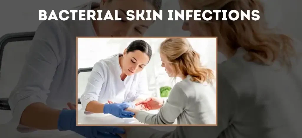 Bacterial Skin Infections